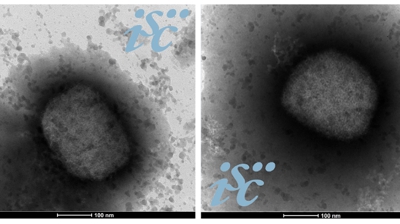 Dúas imaxes, obtidas por microscopía electrónica, do virus da varíola do mono. (Unidade de Microscopía Electrónica do ISCIII)