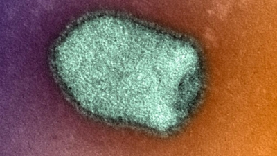 Virus da rabia (Instituto Pasteur)