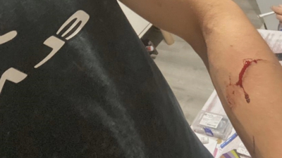 O corte inflixido cun coitelo no brazo da vítima