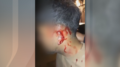 Imaxe da orella do agredido